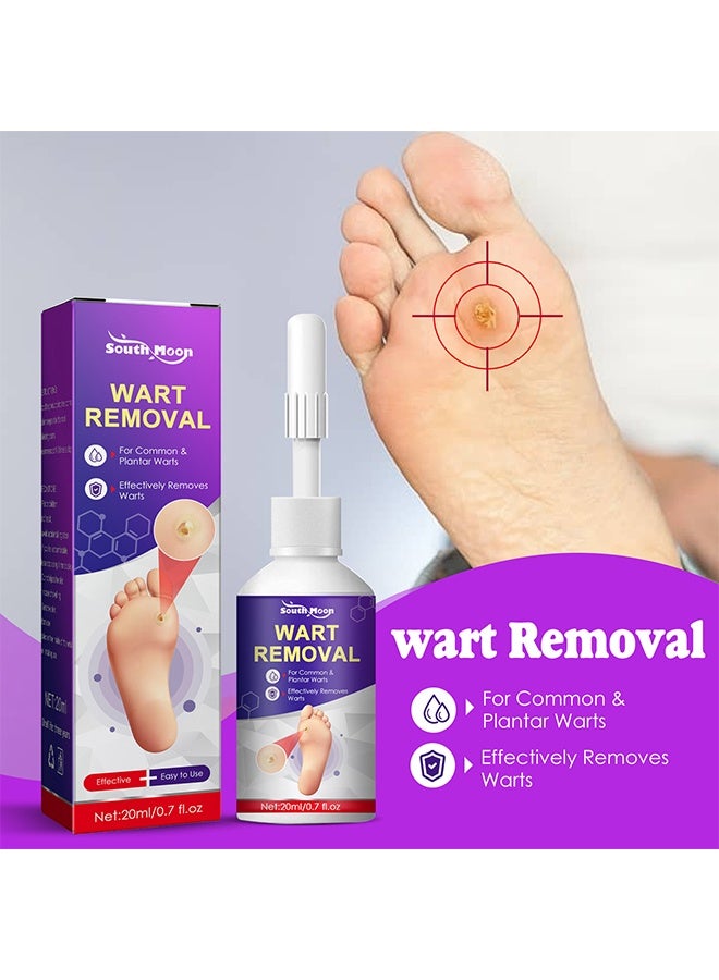 ساوث مون مزيل الثالول والذرة السائل (20 مل)، تركيبة حمض الساليسيليك سريعة المفعول للثآليل الأخمصية والعادية والمسطحة – إزالة فعالة للذرة للقدمين وأصابع القدمين والأصابع واليدين – تجميد الثالول - Image 2