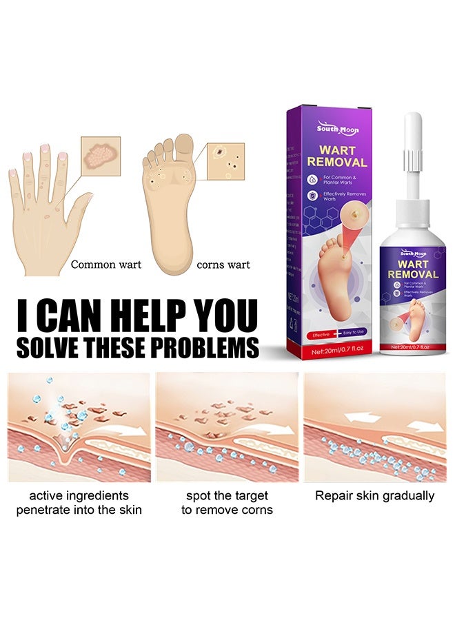 ساوث مون مزيل الثالول والذرة السائل (20 مل)، تركيبة حمض الساليسيليك سريعة المفعول للثآليل الأخمصية والعادية والمسطحة – إزالة فعالة للذرة للقدمين وأصابع القدمين والأصابع واليدين – تجميد الثالول - Image 5