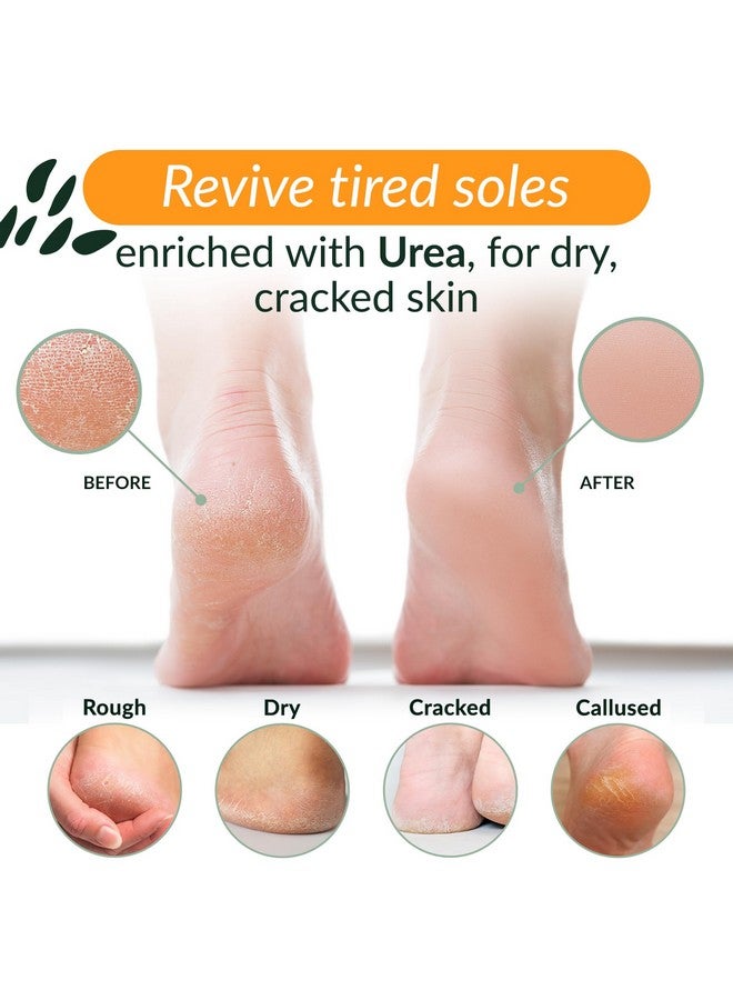 تري تو تيوب كريم القدم للكعوب الجافة المتشققة والقدمين، غسول القدم للقدمين الجافة والمتشققة، مرطب غير دهني للقدم، كريم اليوريا مع زبدة الشيا والكاكاو المنعمة والحمضيات، العناية بالقدم للنساء والرجال - Image 2