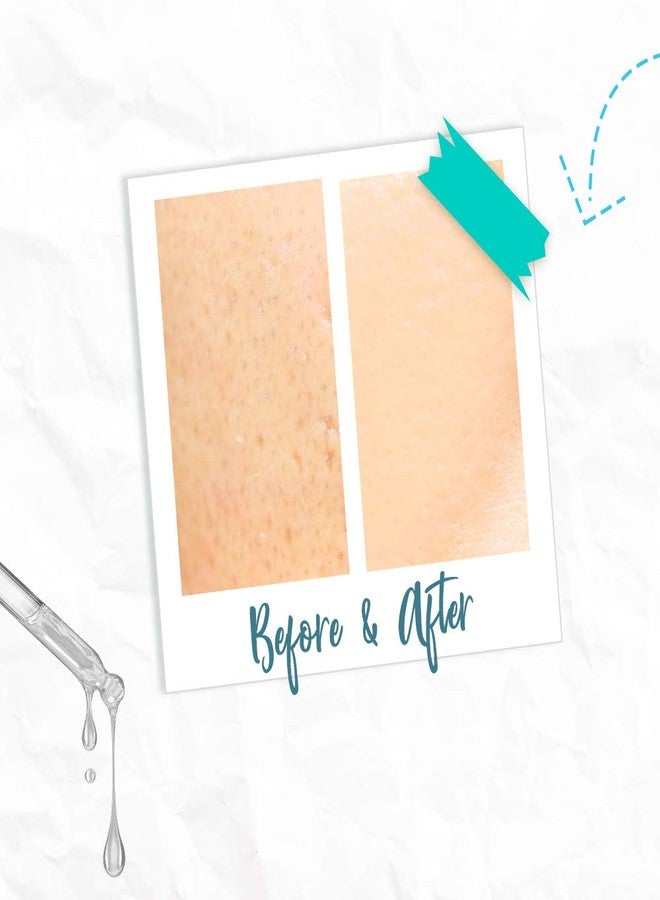Bye Bye Blemish Skin Rescue Niacinamide Serum - Image 4