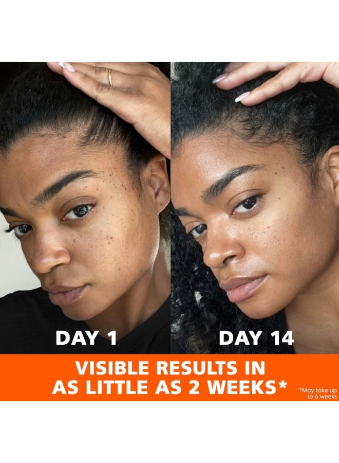 بالمرز كريم Skin Success مع فيتامين E، كريم مضاد للبقع الداكنة 2.7 أونصة (75 جم) - Image 5