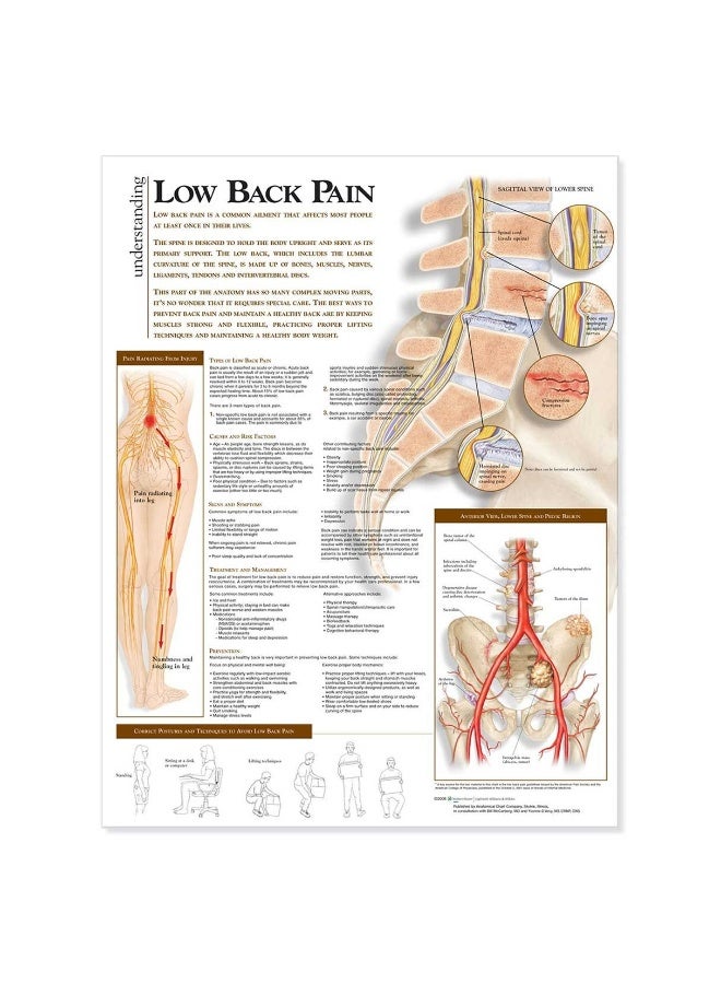Understanding Low Back Pain Anatomical Chart
