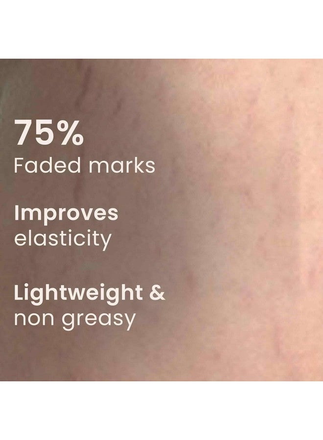 Saffr'n Anti Stretch Marks Cream co-developed by Gynaecologist suitable for all Stretch Marks | With Shea Butter, Hyaluronic Acid, and Collagen | Scar Removal | Uneven Skin Tone | Vitamin C and Retinol | 50ml - Image 2