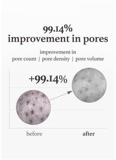 NOONI NOONI Korean Cleansing Oil - Snow Aqua 0 LHA Toning Pore Care Korean Facial Oil Cleanser, 6.76 fl.oz | Makeup Double Cleansing, Glass Skin, Eggie Skin, Blackhead Control, Pore Cleansing Oil for Face  - Image 5