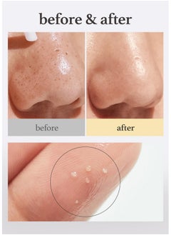 NOONI NOONI Korean Cleansing Oil - Snow Aqua 0 LHA Toning Pore Care Korean Facial Oil Cleanser, 6.76 fl.oz | Makeup Double Cleansing, Glass Skin, Eggie Skin, Blackhead Control, Pore Cleansing Oil for Face  - Image 3