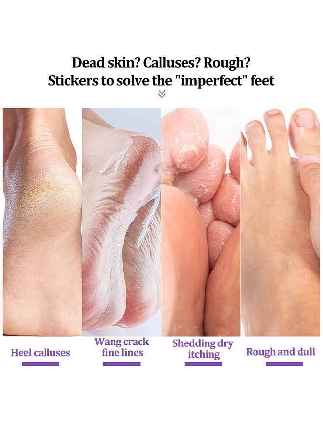 إيلهو قناع القدم بالزنجبيل ، جوارب مرطبة للعناية بالقدم الجافة ، ترطيب القدمين أقنعة التقشير لإصلاح الكعب الجاف المتشقق ، وإزالة الجلد الميت - Image 4