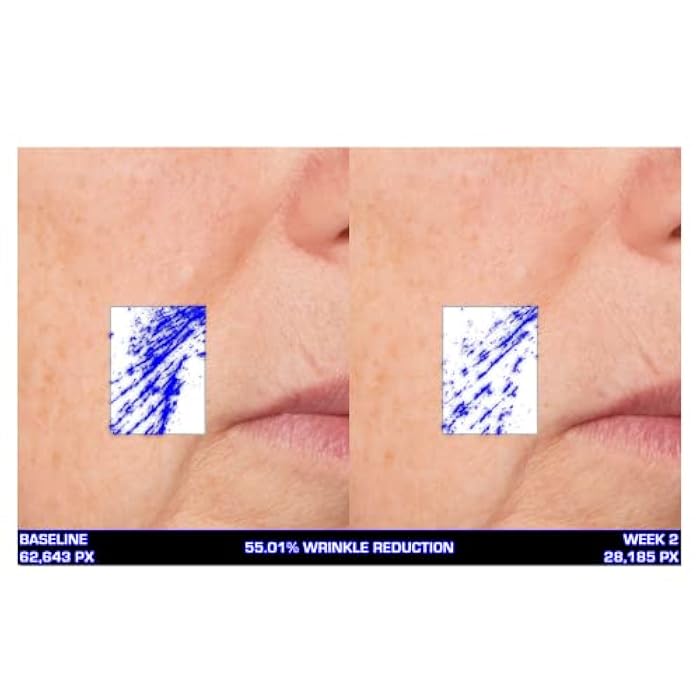 Serious Skincare Ultra-Mare Pure Marine Infusion Facial Serum - Encourages Collagen Production, Cell Turnover and Plumper Skin - Niacinamide - Acid Free - Concentrated 2 oz. - Image 3