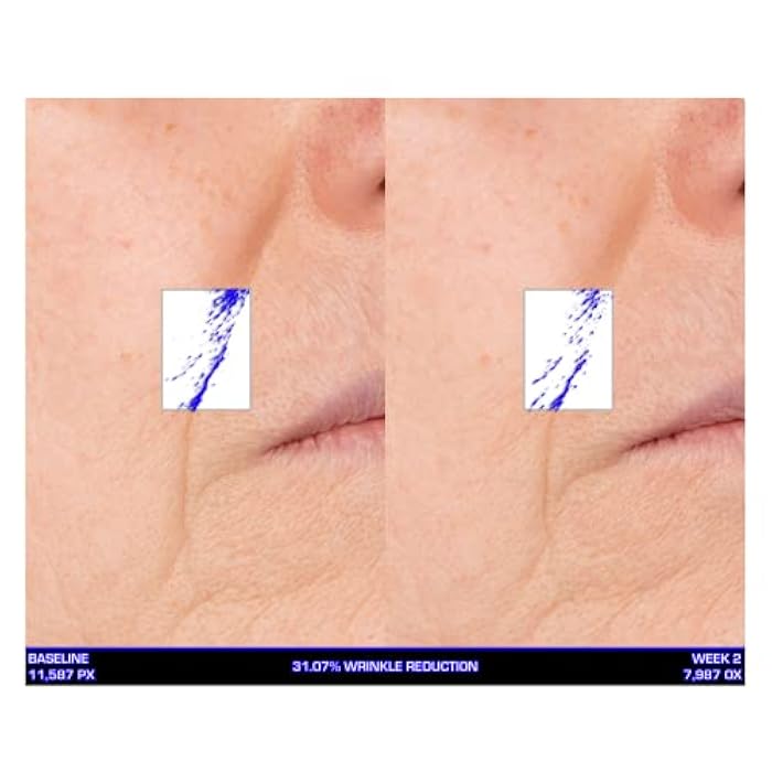 Serious Skincare Ultra-Mare Pure Marine Infusion Facial Serum - Encourages Collagen Production, Cell Turnover and Plumper Skin - Niacinamide - Acid Free - Concentrated 2 oz. - Image 4