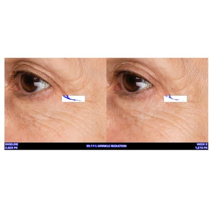 Serious Skincare Ultra-Mare Pure Marine Infusion Facial Serum - Encourages Collagen Production, Cell Turnover and Plumper Skin - Niacinamide - Acid Free - Concentrated 2 oz. - Image 2