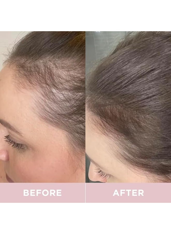 Revive Collagen مشروب كولاجين ريفيف المعزز بكمية 10,000 ملغ من الكولاجين البحري المهدرج مع فيتامين أ و ج لصحة البشرة والشعر والأظافر والمفاصل | استوائي | 28 كيس - Image 5