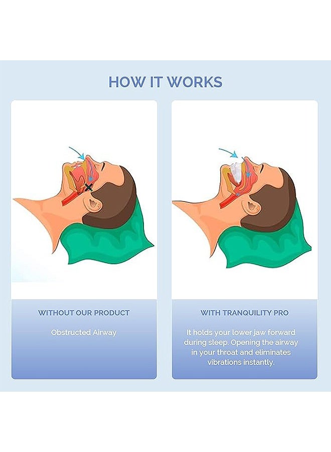 Gecomo Anti-Snoring Mouth Guard, Teeth Grinding and Snore Prevention, Reusable Mouth Guard For Stop Snoring At Night Anti Snoring Devices With Comfort Size Snore Mouth Guard For Men Women - Image 3