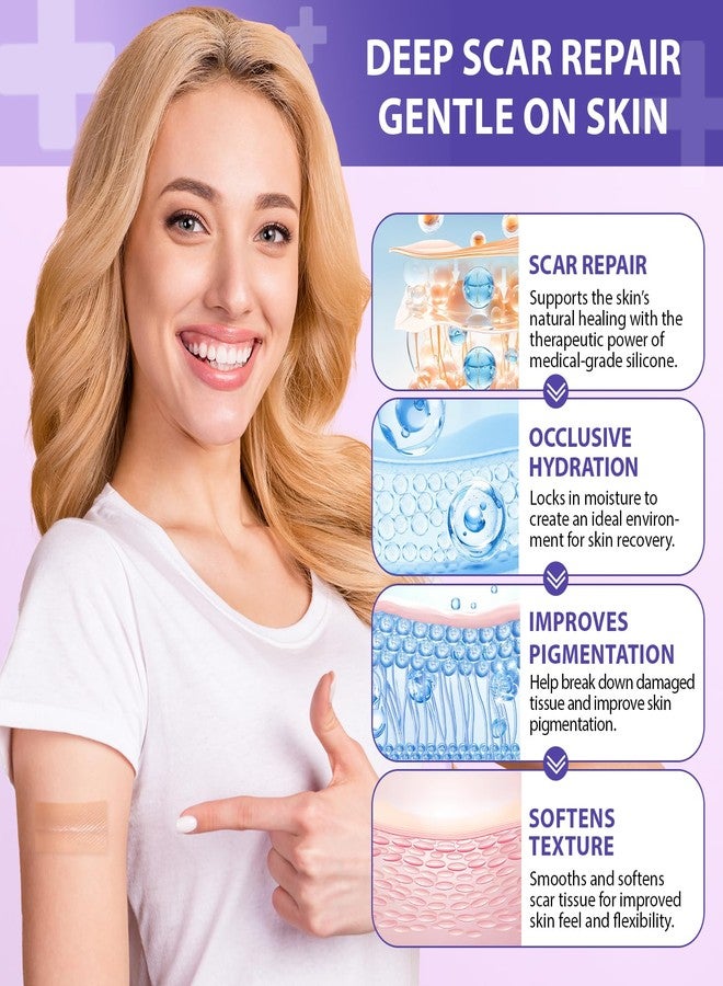 Gorgeurora أوراق السيليكون لعلاج الندبات، شريط السيليكون لعلاج الندبات (1.6 بوصة × 60 بوصة، 1.5 متر) - أوراق سيليكون قابلة لإعادة الاستخدام لعلاج الندبات الجراحية، وندبات القيصرية، والكيليود، والحروق، وحب الشباب، وإزالة نتوءات الكيليود - Image 5