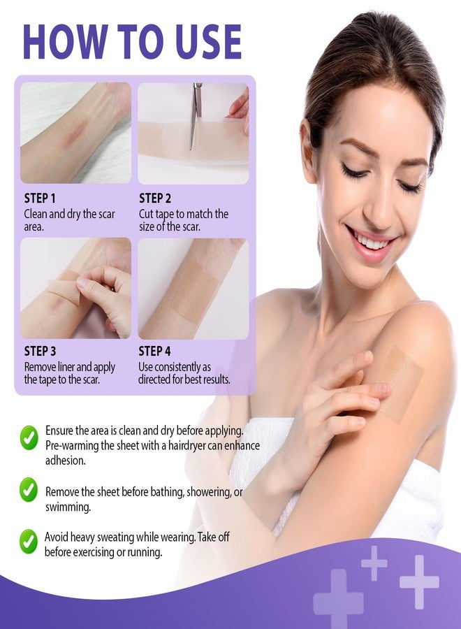 Gorgeurora أوراق السيليكون لعلاج الندبات، شريط السيليكون لعلاج الندبات (1.6 بوصة × 60 بوصة، 1.5 متر) - أوراق سيليكون قابلة لإعادة الاستخدام لعلاج الندبات الجراحية، وندبات القيصرية، والكيليود، والحروق، وحب الشباب، وإزالة نتوءات الكيليود - Image 4