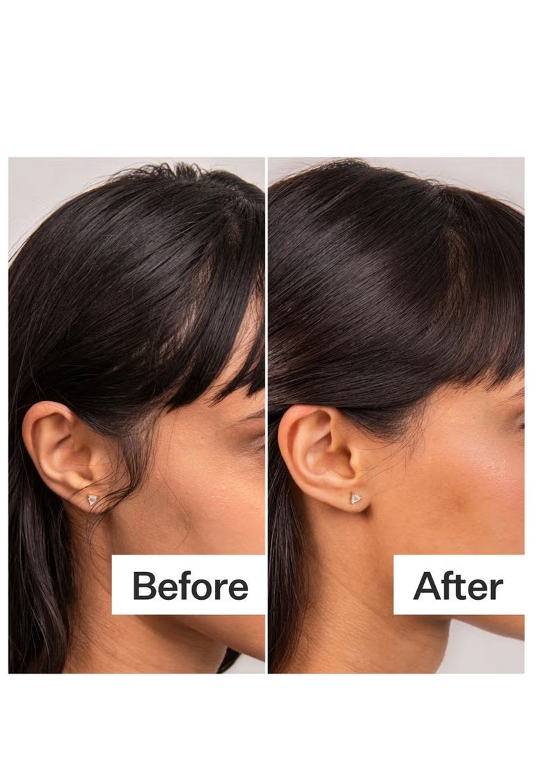 Act+Acre 4% Niacinamide Oily Scalp Serum 65ml - Image 2