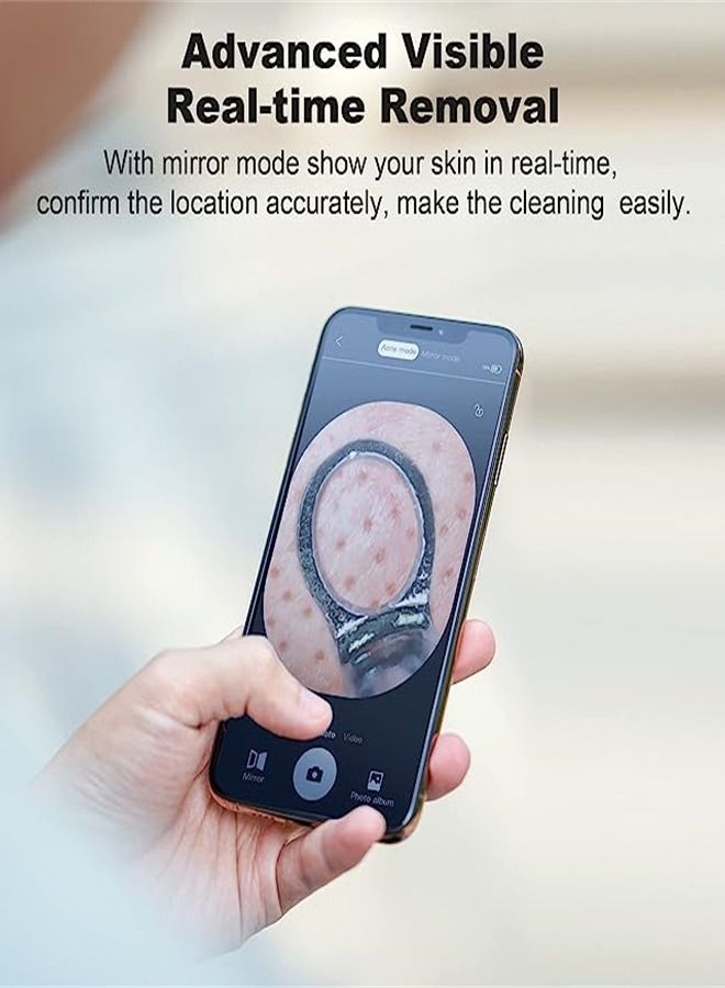 إزالة الرؤوس السوداء، يمكن توصيلها بالهاتف لاستخدام مكبر، لأداة تنظيف عميق وتقشير للبشرة، مزودة بأدوات علاج حب الشباب - Image 3