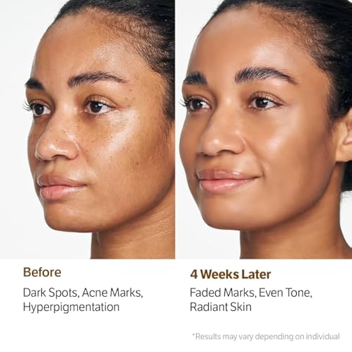 SUNGBOON EDITOR Kojic Capsule Brightening Cleanser | Low pH Gentle Gel Face Wash | Encapsulated Kojic Acid, Turmeric & Niacinamide for Dark Spots, Acne & Blackhead | Korean Skincare, Stocking Stuffers - Image 3