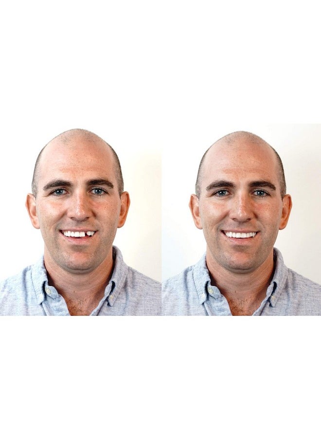 Instant Smile - Triple Shade Temporary Tooth Kit - Replace A Missing Tooth In Just 5 Minutes! - Image 1