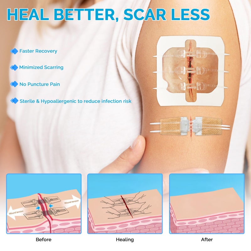 Greetmed Emergency Wound Closure Strips - 16 Pack Laceration Closure Kit with 2 Types Zip Stitch Butterfly Bandage Sutures Kit - Painless, Stitchless Wound Repair for First Aid, Hiking, Camping & Home - Image 5