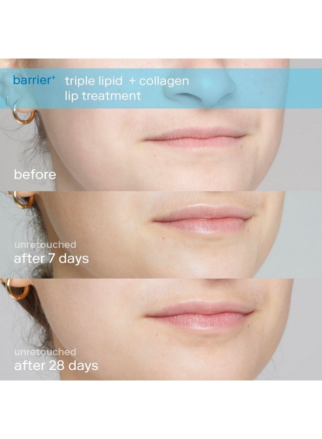 Skinfix Barrier+ Triple Lipid + Collagen Lip Treatment Nourish Dry Chapped Lips With Our Volumizing Complex To Visibly Plump & Fill Fine Lines 0.27 Oz  - Image 3