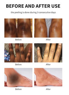 MOOYAM Peeling Oil for Dark Skin, Green Extra Strength Exfoliating Body Peeling Oil,  Peel Solution for Hands and Feet, Effective Exfoliation for Smooth and Radiant Skin  - Image 5