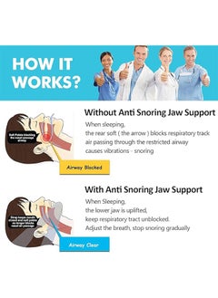 Generic Anti Snoring Chin Strap, Upgrade Anti Snoring Devices, Anti Snoring Devices Anti Snoring Chin Strap for Men Women,Chin Straps Sleep Aids for Snoring Mouth Breather Mouth Closed While Sleeping  - Image 2