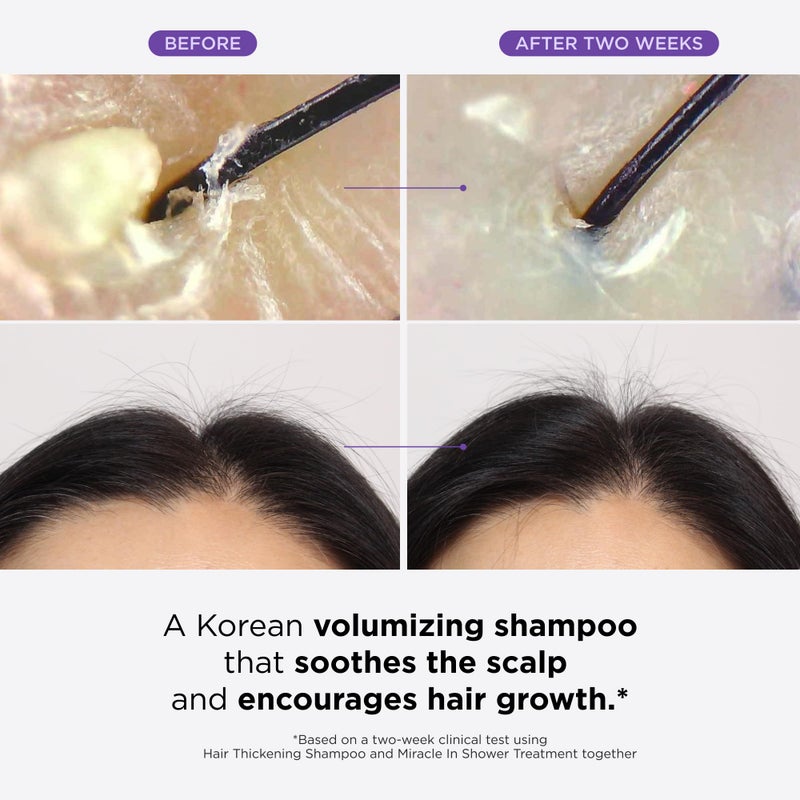 Dr.Groot Dr. Groot Scalp Revitalizing Solution Travel Set for Hair Loss, Korean Hair Care, Hair Thickening Shampoo u0026 Miracle in Shower Treatment, TSA Approved, 5 Seconds to Smooth Hair, Rosemary Oil - Image 3
