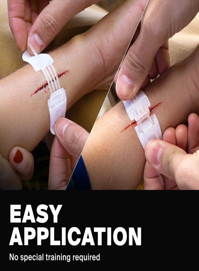SurviveX Zip Stitch Wound Closure Strips - Repair Wounds Without Stitches - Zipstitch Sutures - Laceration Closure First Aid Kit - Image 4