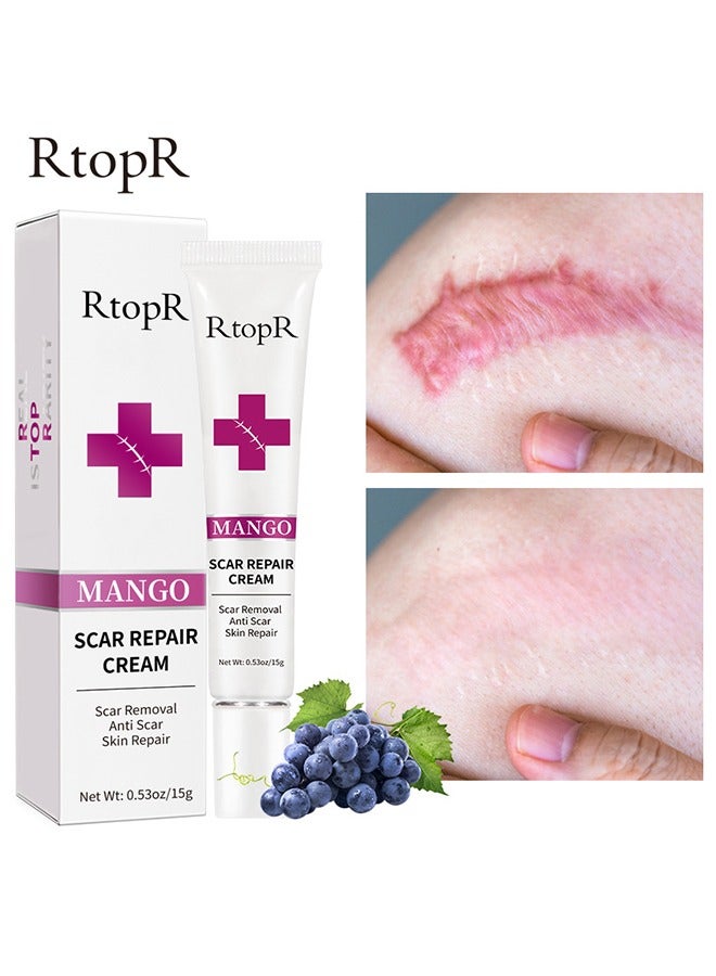 آر توب آر كريم إزالة الندبات - كريمات إصلاح الجلد علاج علامات التمدد حب الشباب الرعاية الجراحية 15G - Image 1
