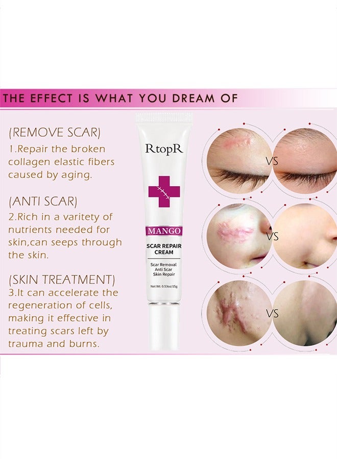 آر توب آر كريم إزالة الندبات - كريمات إصلاح الجلد علاج علامات التمدد حب الشباب الرعاية الجراحية 15G - Image 2