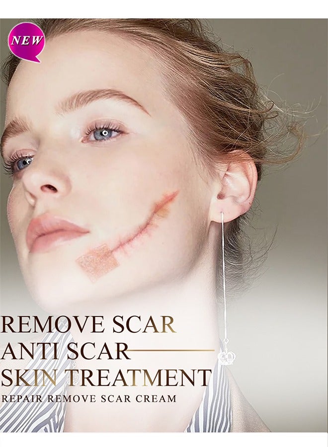 آر توب آر كريم إزالة الندبات - كريمات إصلاح الجلد علاج علامات التمدد حب الشباب الرعاية الجراحية 15G - Image 5