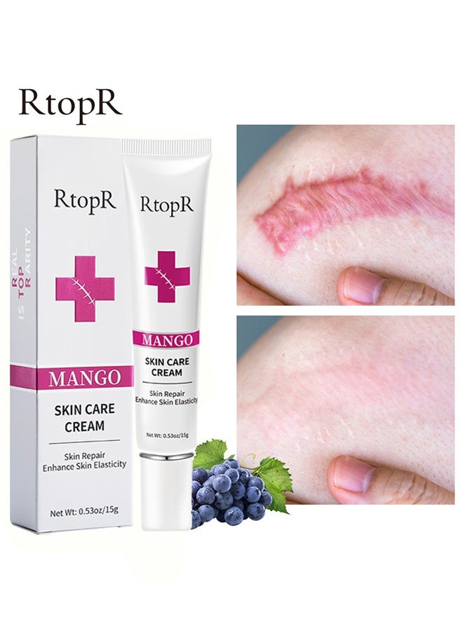 RtopR Scar Removal Cream - Skin Repair Creams Treatment Stretch Marks Acne Surgical Care 15g - Image 1