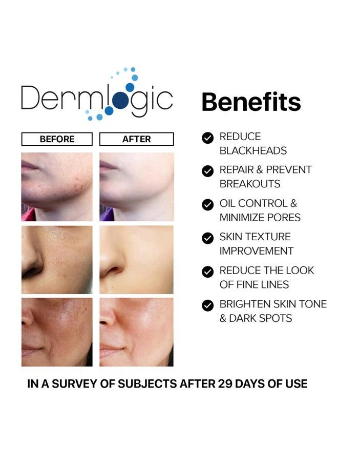 Dermlogic Anti-Blemish Control Pads- Contains Salicylic, Glycolic, Lactic Acid for Face & Body. Clears Away Clogged Pores, Oily Skin & Cystic Breakouts. Removes Dark Spots, Blackhead & Whitehead Pimples - Image 3