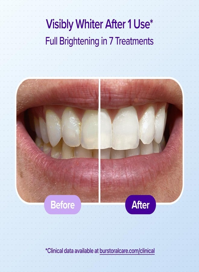 BURST Sensitive Teeth Whitening Strips (Watermelon | 20 Strips/10 Treatments – Each with 1 Upper/1 Lower | Visible Results in 15 Minutes | No-Slip Grip | Enamel-Safe Whitening Kit - Image 3