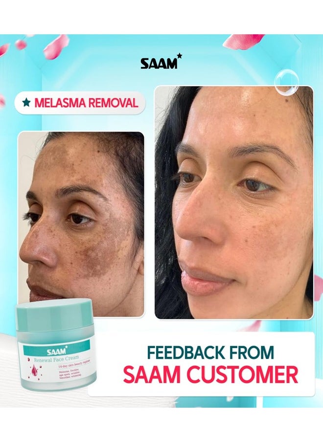 سام تجديد كريم الوجه | ميلاسما ، النمش ، البقع العمرية والبقع الداكنة | مع Alpha Arbutin و Kojic Acid | 50g  - Image 5
