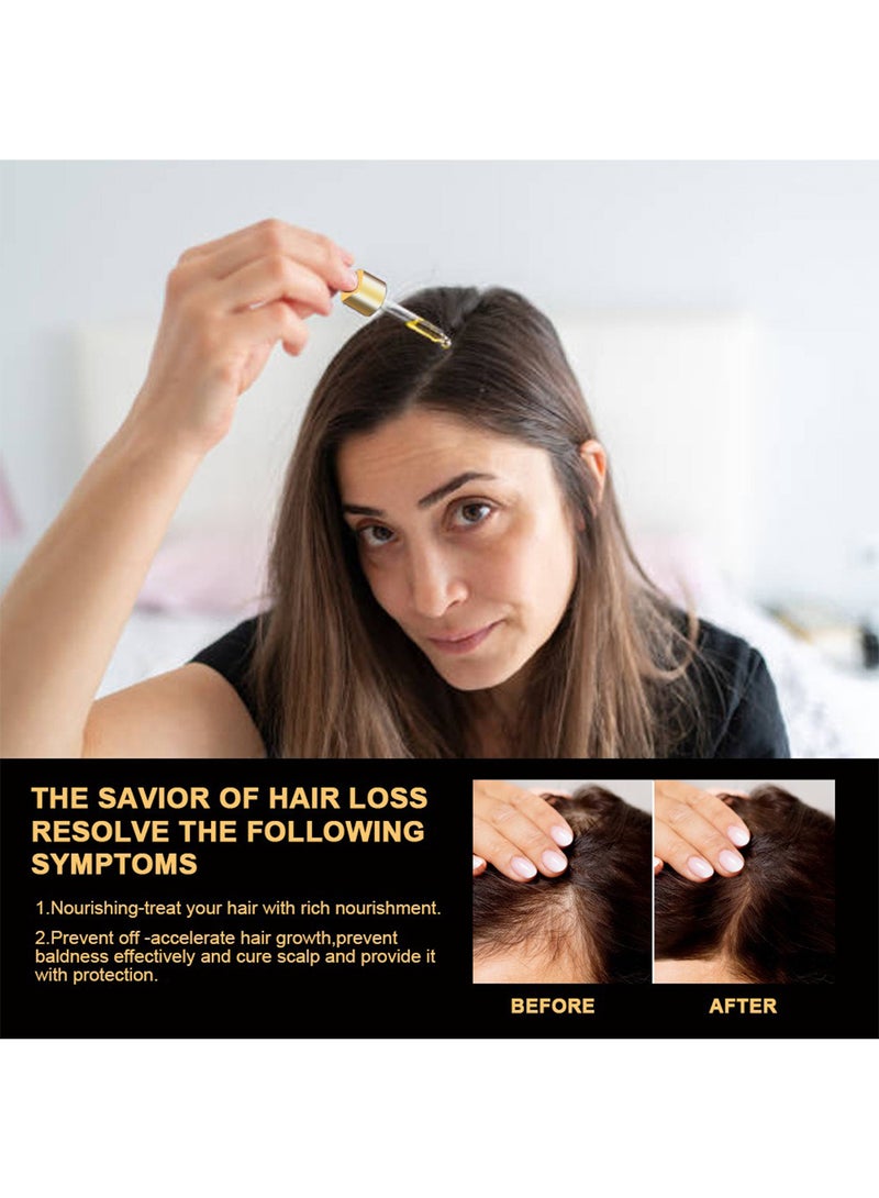 سوميفون لوشن لإصلاح الشعر، زيت للشعر، علاج تساقط الشعر، خلاصة مرطبة مضادة للتساقط، تعزيز صحة الشعر، تقوية نموه 30 مل  - Image 4