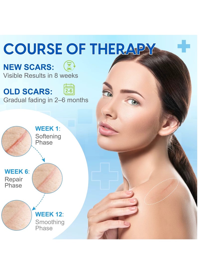 ELBBUB شرائح السيليكون الطبية لعلاج الندبات - 1.5م، شريط السيليكون لعلاج الندبات الكيلويدية، ندبات العمليات الجراحية، إزالة ندبات جراحة شد البطن، لاصقات جل السيليكون لإزالة الندبات. - Image 2