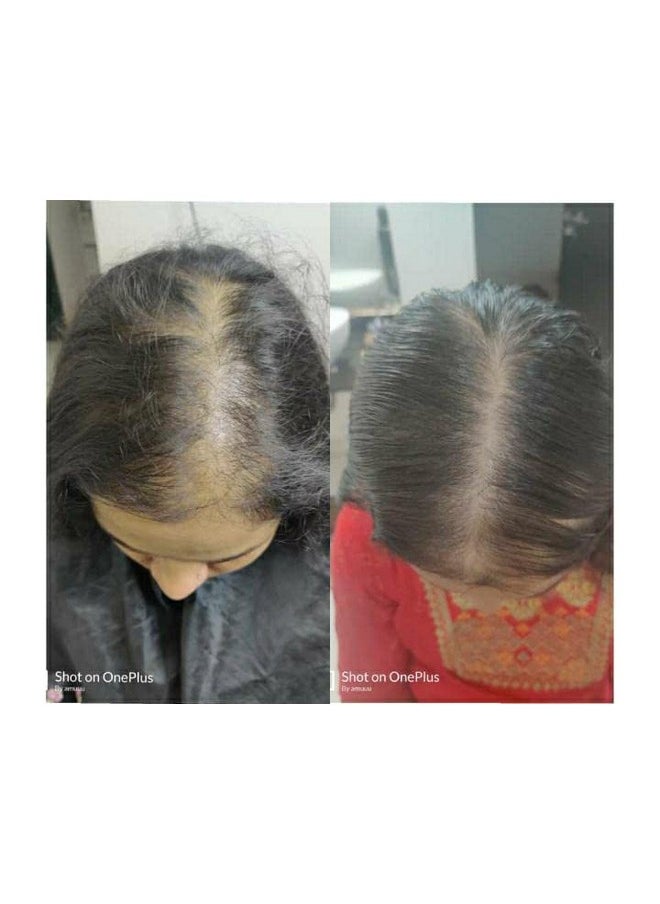 Ancient Wisdom Hair Care Oil Hair Oil For Hairfall Healthy Shiny Problemfree Hair  - Image 5