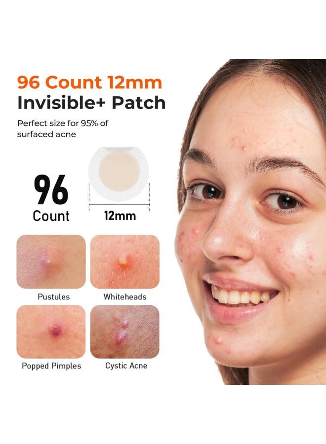 TKTK Pimple Patches, 12mm Invisible Acne Patches for Face with Salicylic Acid, 0.01cm Extra Thin Outer Edge, Hydrocolloid Zit Patch for Pustule, Whitehead, Cystic Acne Spot, 96 Count - Image 5