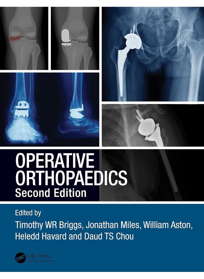 Operative Orthopaedics 