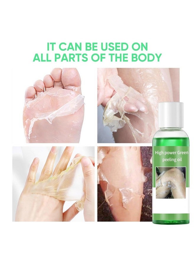 YAFUSIPE Peeling Oil for Dark Skin Green Peeling Oil Solution Extra Strength Exfoliate Body Extra Strong Exfoliating Peels for Hand Feet Dark Knuckle Knee Elbow Chemical Peel Body for All Skin Type 3.38 FLOZ - Image 2