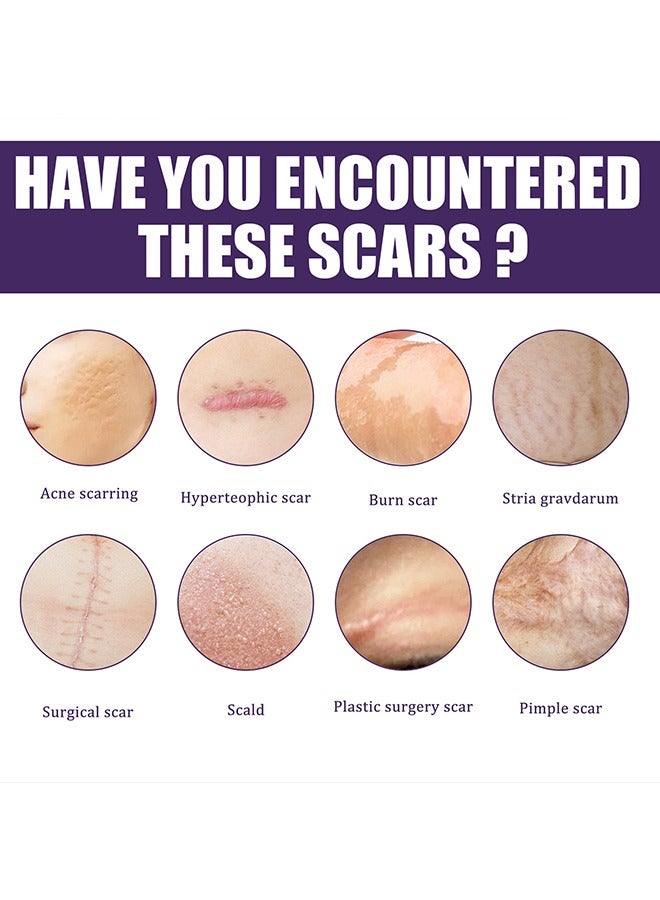 إيلهو 8 قطع رقعة ندبة سيليكون - رقعة ندبة طويلة جدا للولادة القيصرية - إزالة طرزة البطن - الجدرة والندبات الجراحية - رقعة ندبة سيليكون طبية قابلة لإعادة الاستخدام - Image 5