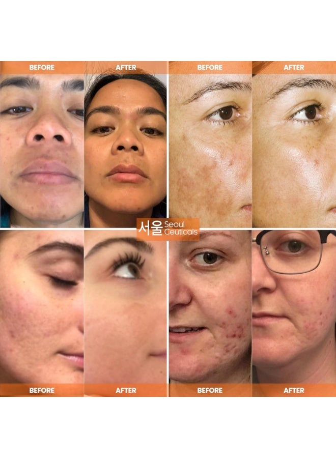 seoulceuticals Korean Skin Care 20% Vitamin C Hyaluronic Acid Serum + CE Ferulic Acid - Potent Anti Aging Vit C, Anti Wrinkle K Beauty Skincare 1oz - Image 3