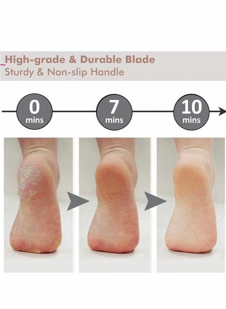 ‌Professional Stainless Steel Foot Rasp - Extra Large Callus Remover & Dead Skin Scrubber for Corns Removal, Pedicure Tool for Thick Hard Skin, Reusable Foot File for Salon/Home Use - Image 2