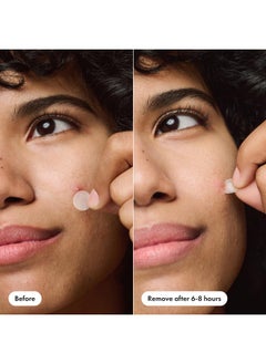 Mighty Patch Mighty Patch™ Invisible+ Patch - The Barely-There Daytime Hydrocolloid Acne Pimple Patch for Covering Zits and Blemishes, Tapered Edges Designed to Blend Into Skin (72ct)  - Image 5