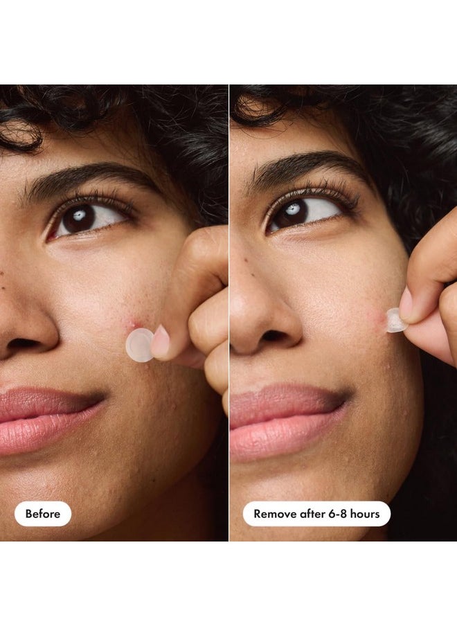Mighty Patch - Mighty Patch™ Invisible+ Patch - The Barely-There Daytime Hydrocolloid Acne Pimple Patch for Covering Zits and Blemishes, Tapered Edges Designed to Blend Into Skin (72ct) - Image 1