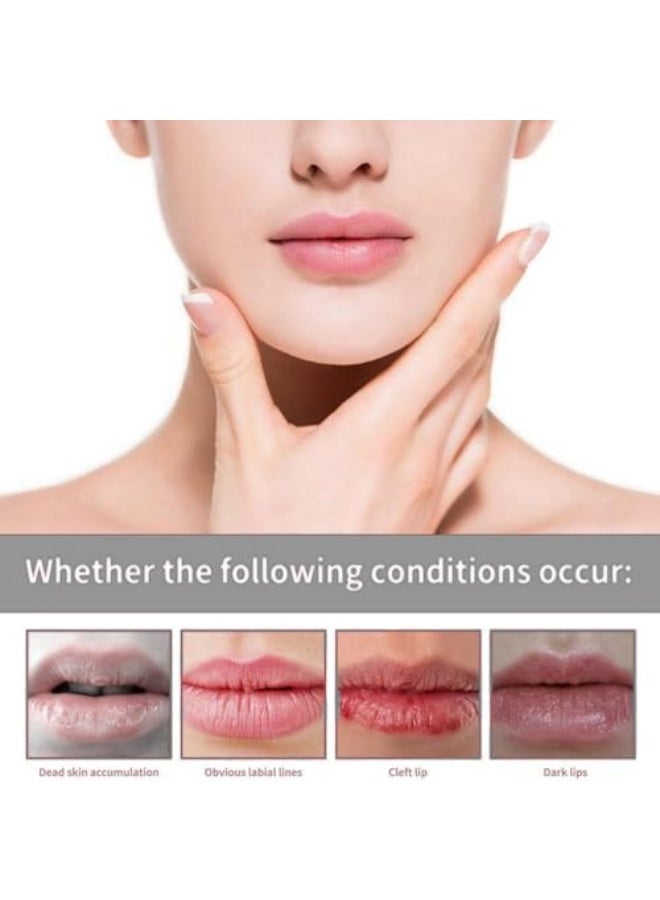 Hoygi Care For Lip, Fordyce Spot Remover for Lips, Lip Brightening for Dark Lips, Pigmentation&Hyperpigmentation Treatment,Moisturizing Balm Stick,Scented Lip Balm for Men&Women, Fades Fine Lines, Long-Lasting Care - Image 4