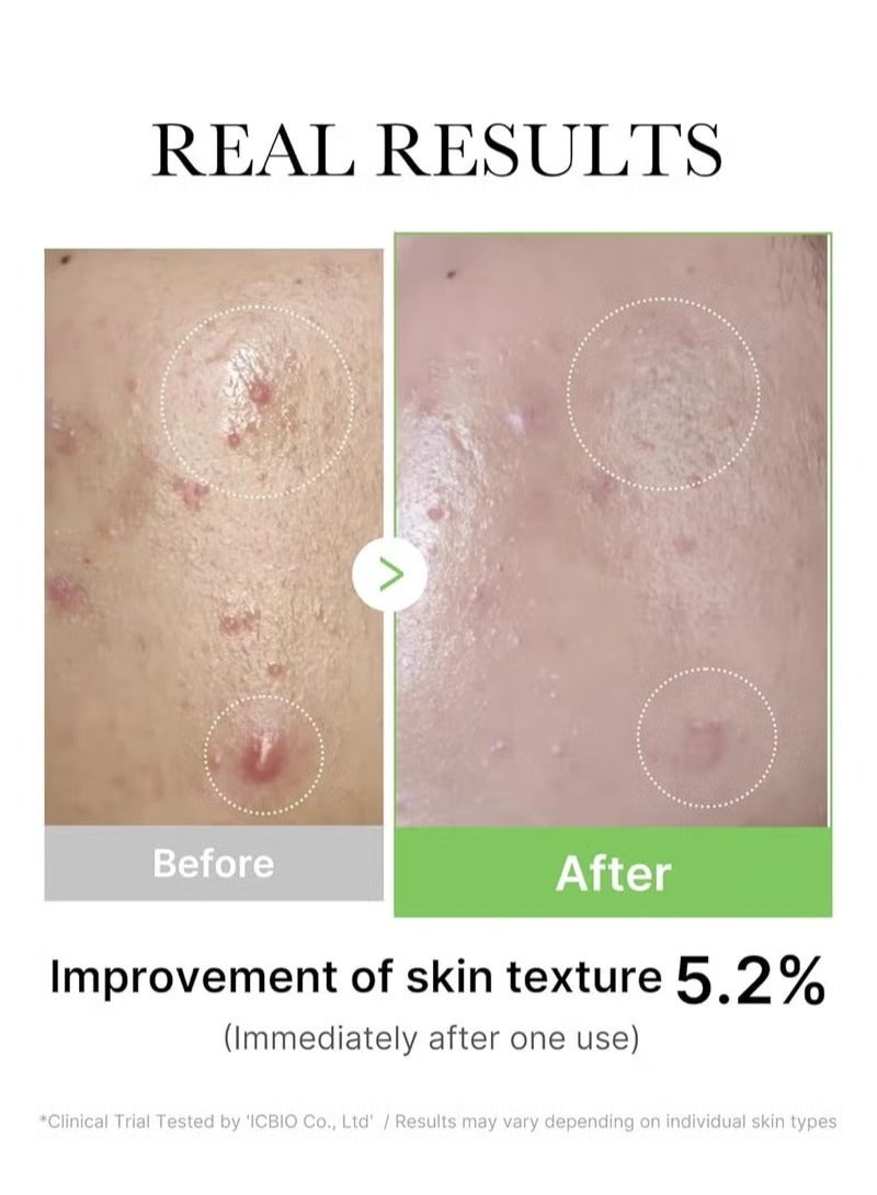 ميديكيوب Medicube Exosome CICA Serum 30ml - Image 4