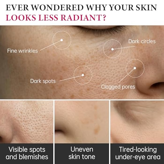 EELHOE 2Pcs Arbutin 7% + Tranexamic Acid 4% Cream, 70,000ppm Arbutin & 40,000ppm TXA,Moisturizing, Hydrating, Even Skin Tone,Reduces Dark Spots & Pigmentation - Image 3