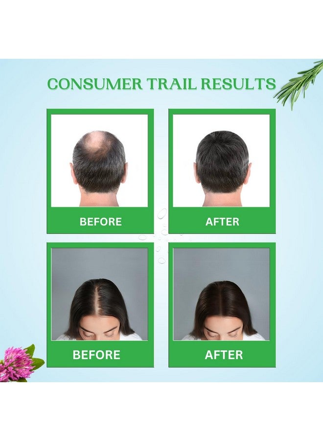 Exotic Aromas -Exotic Hair Boost Serum With 3% Redensyl, 3% Rosemary, 4% Anagain & 4% Biacapil, 30 Ml, For Hair Loss, Hair Growth, Thinning, Baldness, For Thicker & Denser Hair. For Men & Women - Image 4
