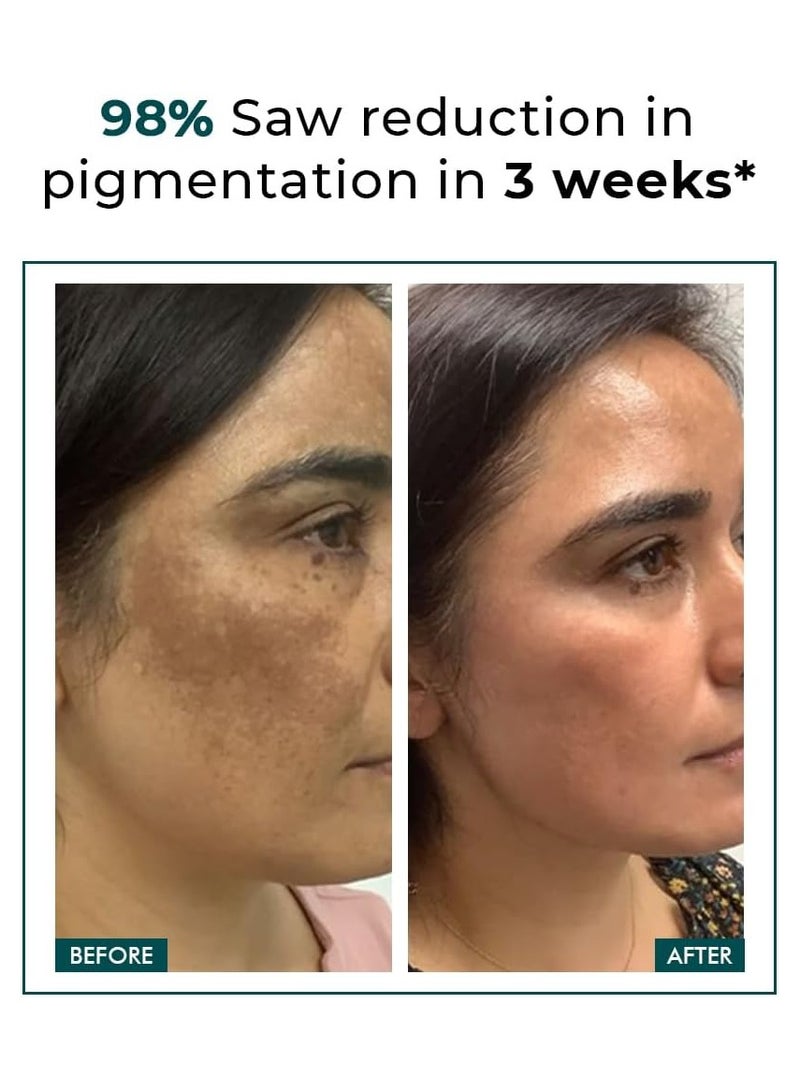 كيميائي واعي كريم الوجه بحمض الكوجيك من كونشوس كيميست | ٥٠ غرام | - تروبيوم - Image 2